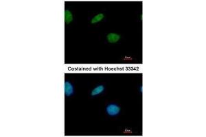 ICC/IF Image Immunofluorescence analysis of paraformaldehyde-fixed A549, using LXR beta, antibody at 1:500 dilution. (NR1H2 anticorps  (N-Term))
