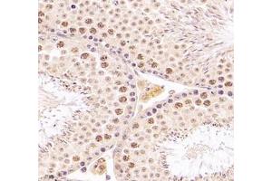 Immunohistochemistry of paraffin embedded mouse testis using DMRTA2 (ABIN7073753) at dilution of 1: 700 (400x lens)