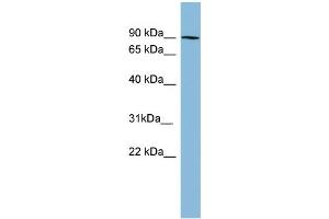 WB Suggested Anti-PRKCB1 Antibody Titration: 0.