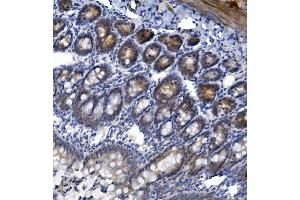 IHC analysis of TTK using anti-TTK antibody (ABIN7601844).