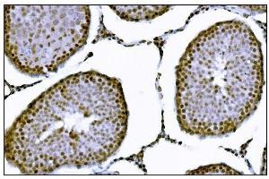 IHC analysis of KMT1B/SUV39H2 using anti-KMT1B/SUV39H2 antibody (ABIN7602135). (SUV39H2 anticorps  (AA 6-410))