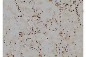 ABIN6274778 at 1/100 staining Human lung tissue by IHC-P. (RPL30 anticorps  (C-Term))
