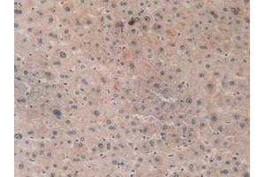 IHC-P analysis of Human Liver Tissue, with DAB staining. (ACAT2 anticorps  (AA 1-397))