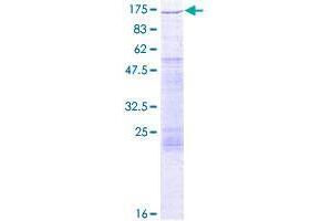 Image no. 1 for Fucokinase (FUK) (AA 1-1084) protein (GST tag) (ABIN1354508)