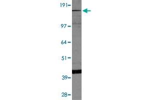 Western blot of HepG2 cell lysate with Kdm6b polyclonal antibody . (Kdm6b anticorps  (AA 600-650))