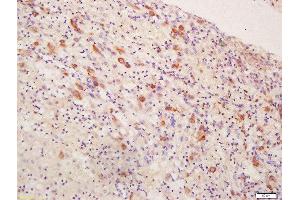 Formalin-fixed and paraffin embedded human placenta tissue labeled with Rabbit Anti-Inhibin Alpha Polyclonal Antibody, Unconjugated (ABIN1715125) at 1:200 followed by conjugation to the secondary antibody and DAB staining