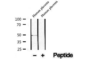 Western blot analysis of extracts of Human placenta tissue, using WIPI2 Antibody.