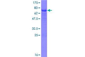 Image no. 1 for Inositol Polyphosphate-1-Phosphatase (INPP1) (AA 1-399) protein (GST tag) (ABIN1307945)