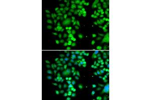 Immunofluorescence analysis of MCF7 cell using PHYHD1 antibody.
