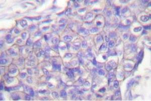 Image no. 2 for anti-CD40 (CD40) antibody (ABIN271944) (CD40 anticorps)
