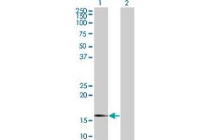 Western Blot analysis of SNCG expression in transfected 293T cell line by SNCG monoclonal antibody (M01A), clone 2C3.