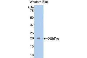 Detection of Recombinant IL18, Human using Polyclonal Antibody to Interleukin 18 (IL18)