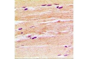 Immunohistochemical analysis of CGRP2 staining in rat heart formalin fixed paraffin embedded tissue section.