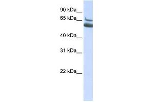 ALOX15B antibody used at 1 ug/ml to detect target protein. (ALOX15B anticorps  (N-Term))
