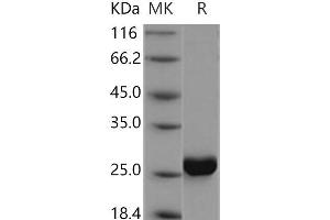 Western Blotting (WB) image for Cytidine Monophosphate (UMP-CMP) Kinase 1, Cytosolic (CMPK1) protein (His tag) (ABIN7195354)