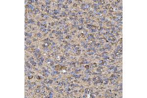 IHC analysis of RAB3GAP1 using anti-RAB3GAP1 antibody (ABIN7599702). (RAB3GAP1 anticorps  (AA 109-810))