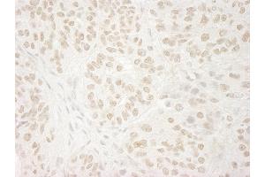 Immunohistochemistry (IHC) image for anti-Ubiquitin Specific Peptidase 37 (USP37) (C-Term) antibody (ABIN7448856)