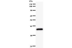 Western Blotting (WB) image for anti-LIM Homeobox 2 (LHX2) antibody (ABIN930948)