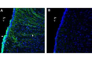 Expression of GPR142 in rat ventromedial hypothalamus. (GPR142 anticorps  (Extracellular))