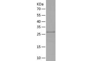 Western Blotting (WB) image for Nitrilase Family, Member 2 (NIT2) (AA 1-276) protein (His-IF2DI Tag) (ABIN7124180)