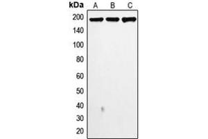 Western blot analysis of Topoisomerase 2 alpha expression in MDAMB468 (A), MDAMB231 (B), HeLa (C) whole cell lysates. (Topoisomerase II alpha anticorps  (N-Term))