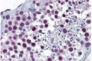 Human Testis: Formalin-Fixed, Paraffin-Embedded (FFPE) (ARNT anticorps  (AA 1-110))