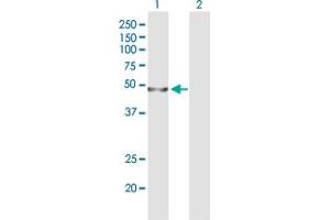 Western Blot analysis of WDR41 expression in transfected 293T cell line by WDR41 polyclonal antibody (A01). (WDR41 anticorps  (AA 1-459))