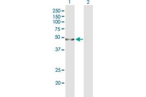 Western Blot analysis of WDR41 expression in transfected 293T cell line by WDR41 polyclonal antibody (A01).