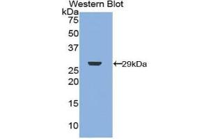 Western Blotting (WB) image for anti-Neurofibromin 2 (NF2) (AA 30-239) antibody (ABIN1859996) (Merlin anticorps  (AA 30-239))