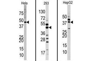 Western blot analysis of anti-MAPK1 Antibody (Center) Pab in Hela, 293, and HepG2 cell line lysates. (ERK2 anticorps  (Middle Region))