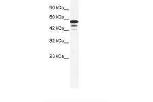 Image no. 1 for anti-Zinc Finger Protein 230 (ZNF230) (AA 133-182) antibody (ABIN6735984) (ZNF230 anticorps  (AA 133-182))