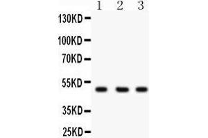 Western Blotting (WB) image for anti-C-terminal Binding Protein 2 (CTBP2) (AA 321-445) antibody (ABIN3042768) (CTBP2 anticorps  (AA 321-445))