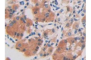 Detection of DDX58 in Human Stomach Tissue using Polyclonal Antibody to Probable ATP-dependent RNA Helicase DDX58 (DDX58) (DDX58 anticorps  (AA 550-776))