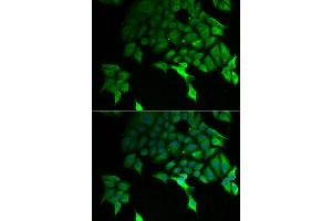 Immunofluorescence analysis of U2OS cell using TSC22D3 antibody. (TSC22D3 anticorps)