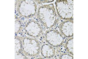 Immunohistochemistry of paraffin-embedded human stomach using BCL2L2 antibody (ABIN5970504) at dilution of 1/100 (40x lens). (BCL2L2 anticorps)
