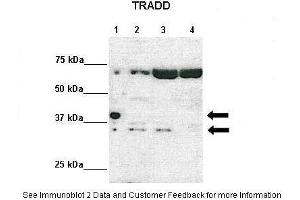Lanes:   Lane 1: 10ug Tradd-HA-Strep-stable expression 293TREXFlpIn cells-Doxycycline induced Lane 2: 10ug ITradd-HA-Strep-stable expression 293TREXFlpIn cells-non-induced Lane 3: 10ug siRNA scrambled-MDA-MB-231 cells Lane 4: siRNA Tradd-MDA-MB-231 cells  Primary Antibody Dilution:    1:1000  Secondary Antibody:   Anti-rabbit HRP  Secondary Antibody Dilution:    1:2000  Gene Name:   TRADD  Submitted by:   Dr. (TRADD anticorps  (Middle Region))