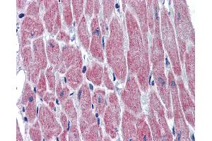 Anti-WNT10B antibody IHC of human heart.