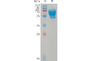 Human AC Protein, hFc Tag on SDS-PAGE under reducing condition.