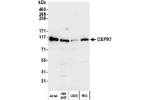 anti-Centrosomal Protein 97kDa (CEP97) (AA 675-725) antibody