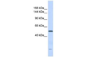 DNA2L antibody used at 1 ug/ml to detect target protein. (DNA2 anticorps  (Middle Region))