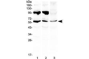 Western blot testing of 1) rat liver, 2) mouse liver and 3) human HepG2 lysate with PLIN1 antibody at 0.