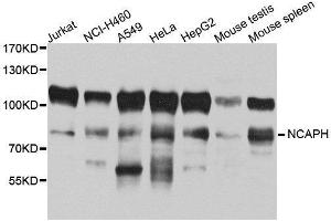 Western Blotting (WB) image for anti-Non-SMC Condensin I Complex, Subunit H (NCAPH) (AA 1-250) antibody (ABIN1680979) (NCAPH anticorps  (AA 1-250))