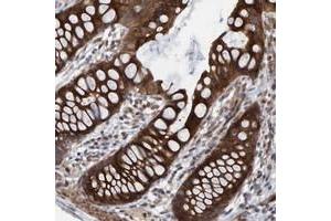 Immunohistochemical staining of human rectum with LRBA polyclonal antibody  strong cytoplasmic positivity in glandular cells.