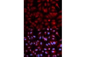 Immunofluorescence analysis of U2OS cells using PSMB5 antibody. (PSMB5 anticorps)