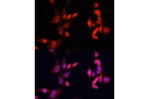 Immunofluorescence analysis of HeLa cells using IR antibody (ABIN6130497, ABIN6142514, ABIN6142515 and ABIN6216327) at dilution of 1:100.