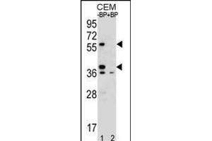 Western blot analysis of MNDA Antibody (N-term) Pab (ABIN655190 and ABIN2844806) pre-incubated without(lane 1) and with(lane 2) blocking peptide in CEM cell line lysate. (MNDA anticorps  (N-Term))