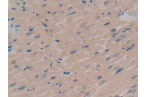 Detection of SGK1 in Mouse Heart Tissue using Polyclonal Antibody to Serum/Glucocorticoid Regulated Kinase 1 (SGK1) (SGK1 anticorps  (AA 145-386))