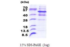 SDS-PAGE (SDS) image for Pellino Homolog 2 (Drosophila) (PELI2) (AA 1-420) protein (His tag) (ABIN5853851)