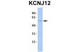 Host:  Rabbit  Target Name:  KCNJ12  Sample Type:  Human Fetal Liver  Antibody Dilution:  1.