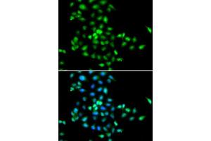 Immunofluorescence analysis of MCF-7 cells using SBDS antibody.
